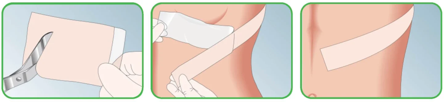 Kako namestiti Mepiform